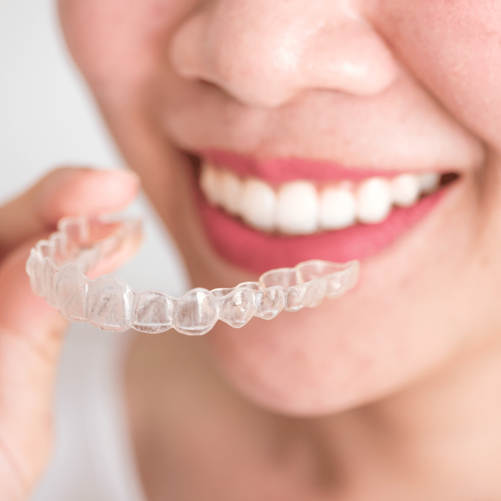 Different Types of Dental Braces: Exploring Each Option