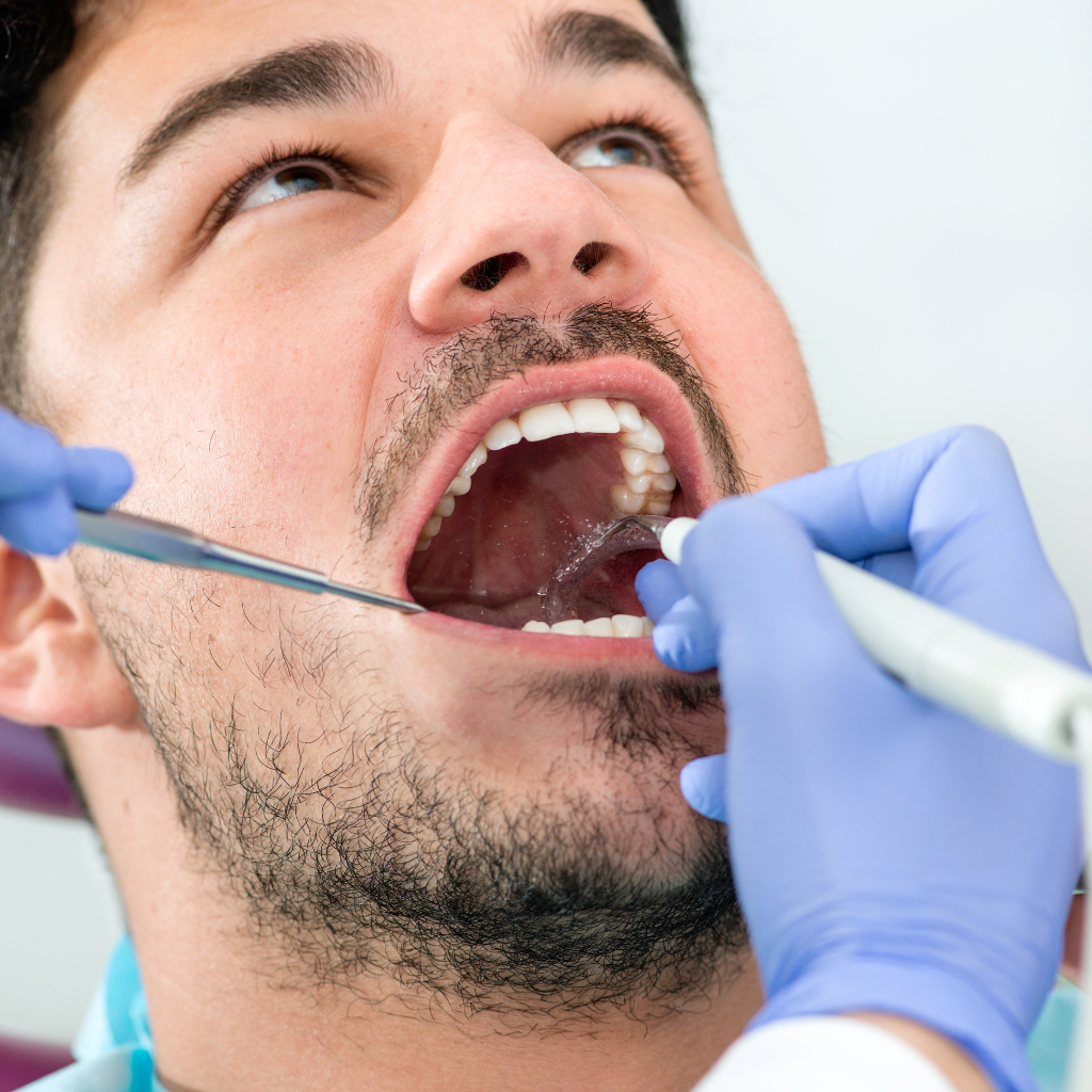How to Remove Plaque From Teeth With Safe Dental Tooth Care Tips