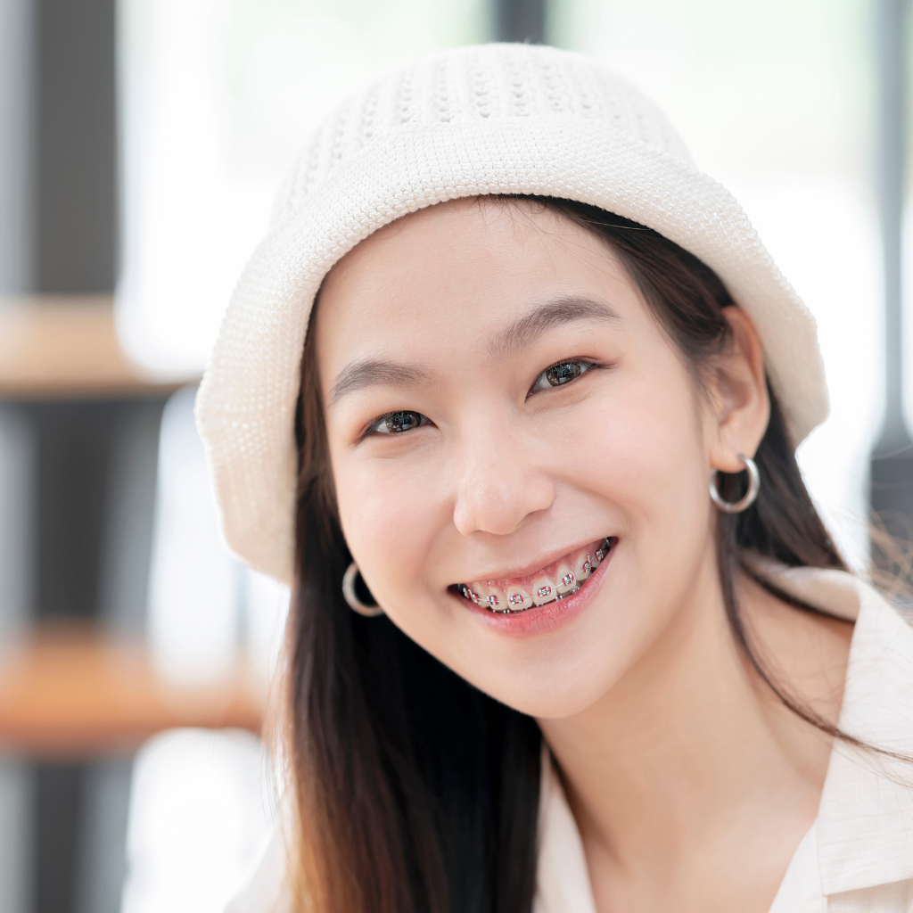 What Is Average Age for Braces? Age to Get Braces and Start Orthodontics