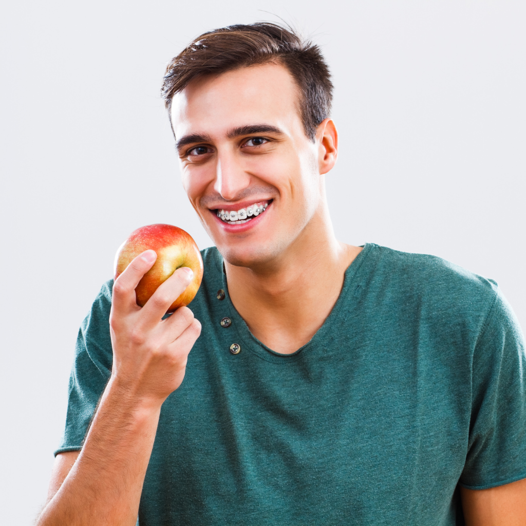 What to Eat After Having Braces: Foods to Eat After You Get Braces