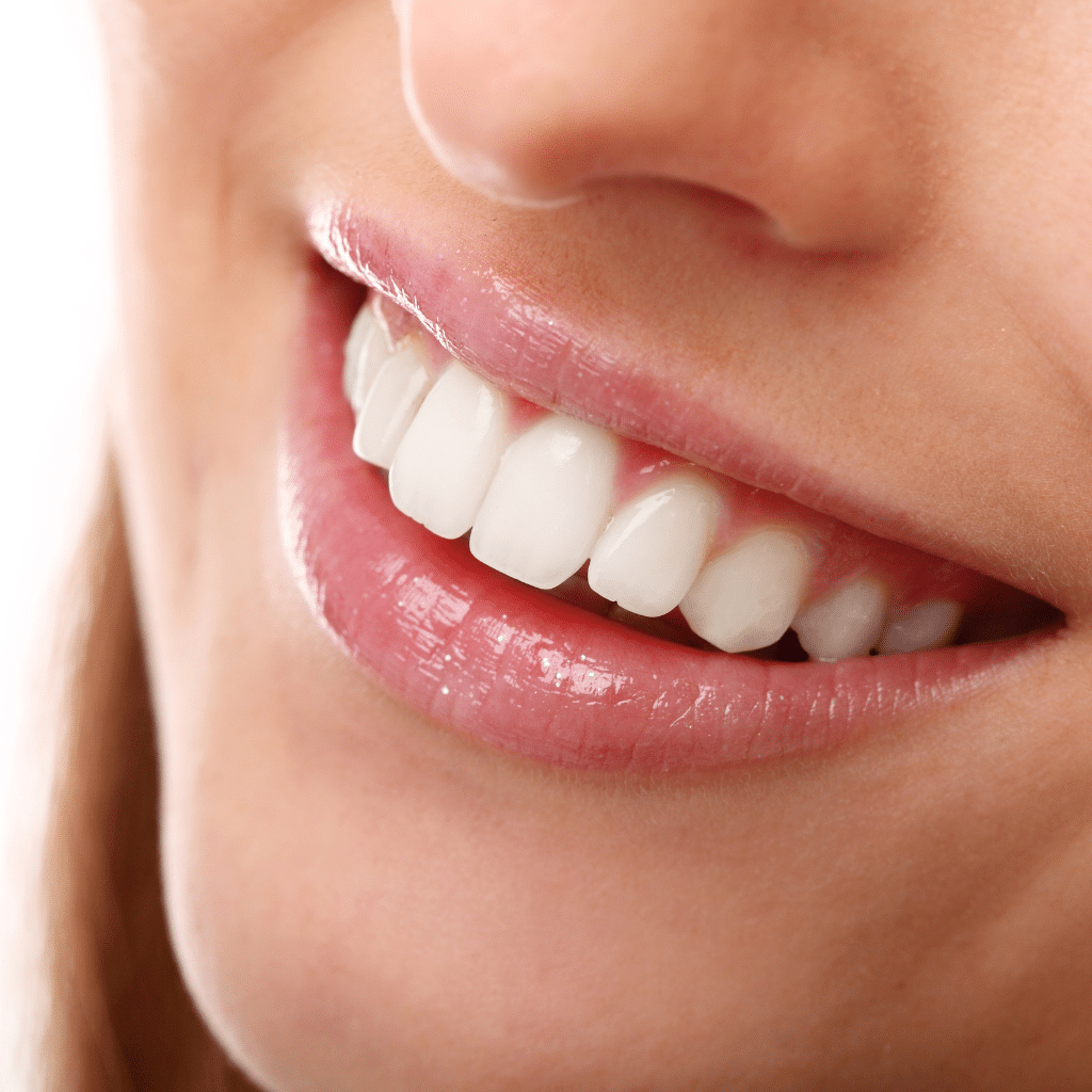 how long does it take to fix overlapping teeth